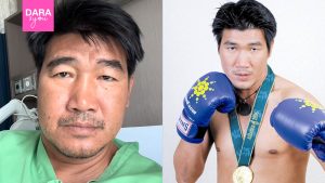 “สมรักษ์ คำสิงห์” อัปเดตอาการ หลังร่างกายทรุดหนัก เส้นเลือดในสมองตีบ